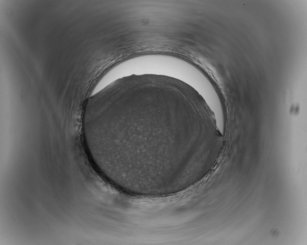 X0000099490017200805291116