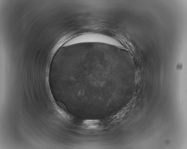 X0000099490051200805291115