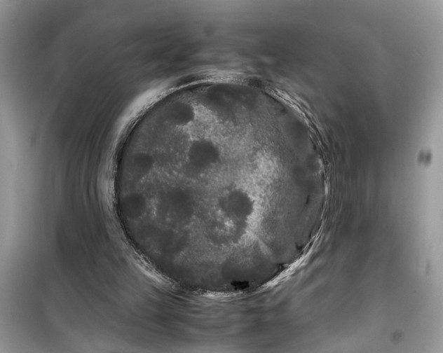 X0000099490149200805291114