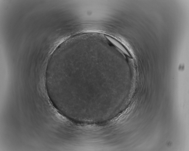 X0000099490385200805291111