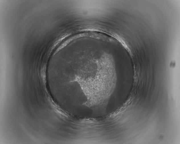 X0000099490386200805291111