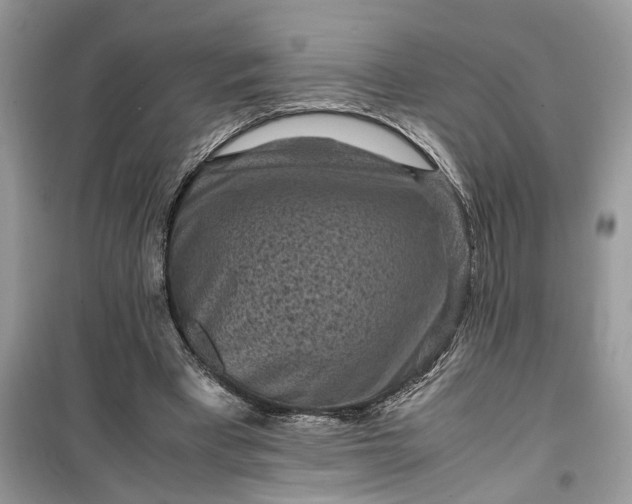 X0000099490393200805291111