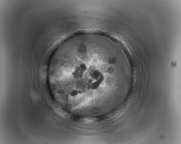 X0000099490495200805291110