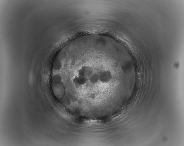 X0000099490499200805291110