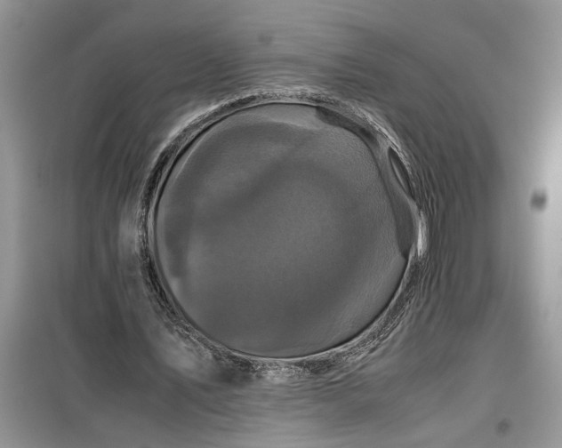 X0000099490579200805291108