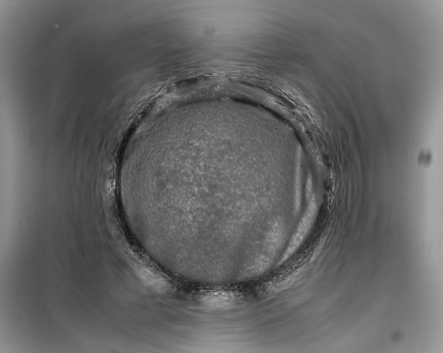 X0000099490593200805291108