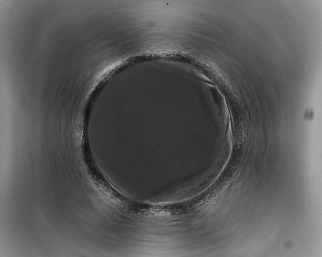 X0000099490640200805291107