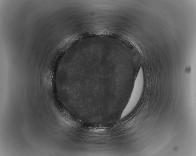 X0000099490643200805291107