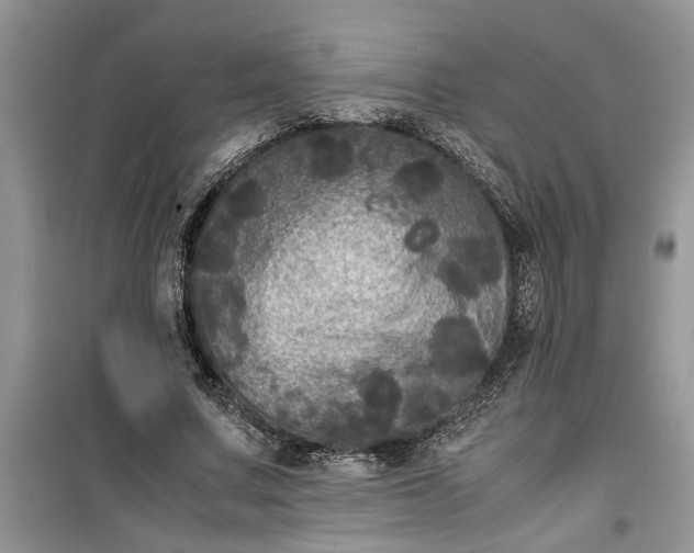 X0000099490683200805291107