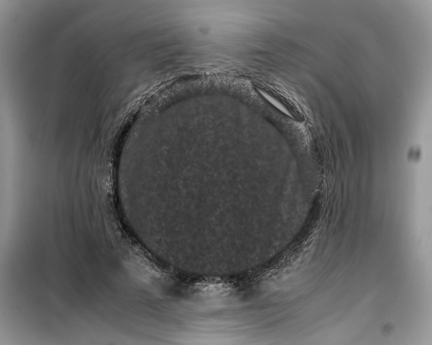 X0000099490689200805291107