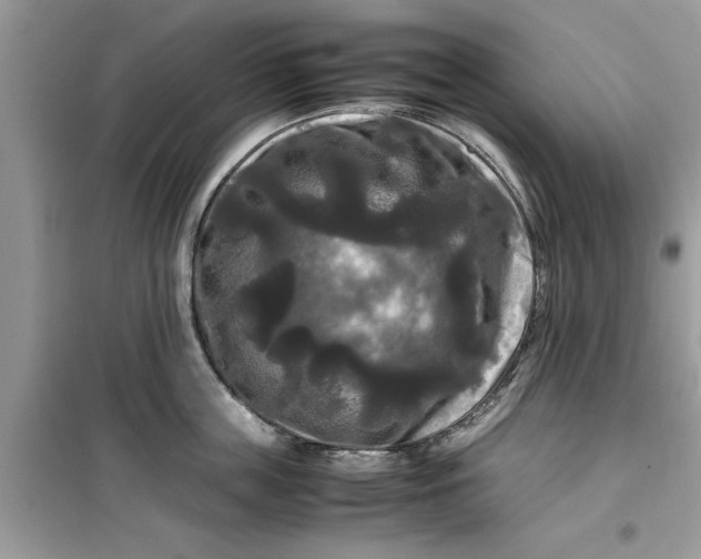 X0000099490859200805291105