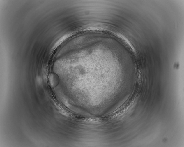 X0000099490874200805291105