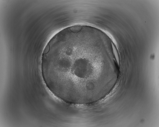 X0000099490903200805291104