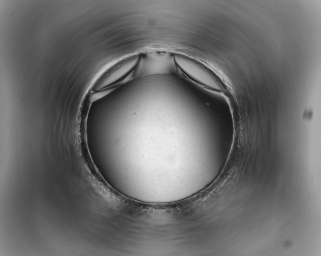 X0000099490976200805291103