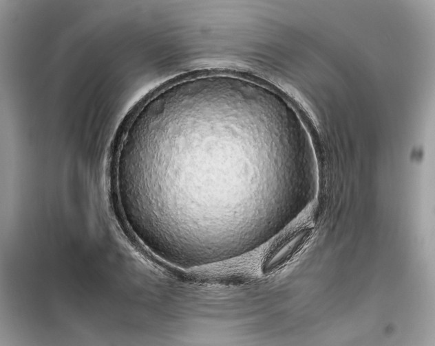 X0000099490983200805291103