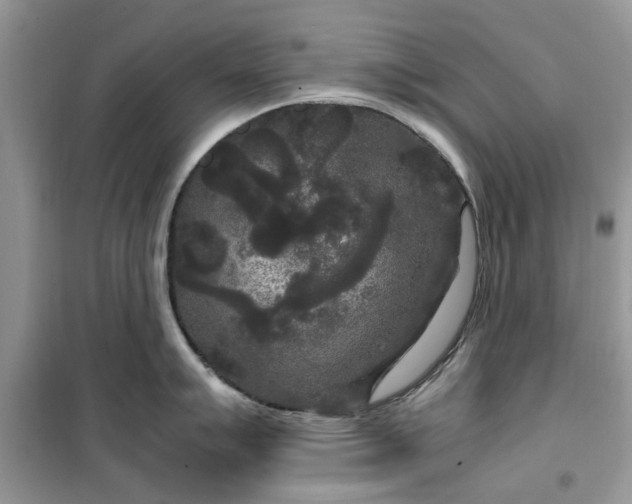 X0000099491007200805291103