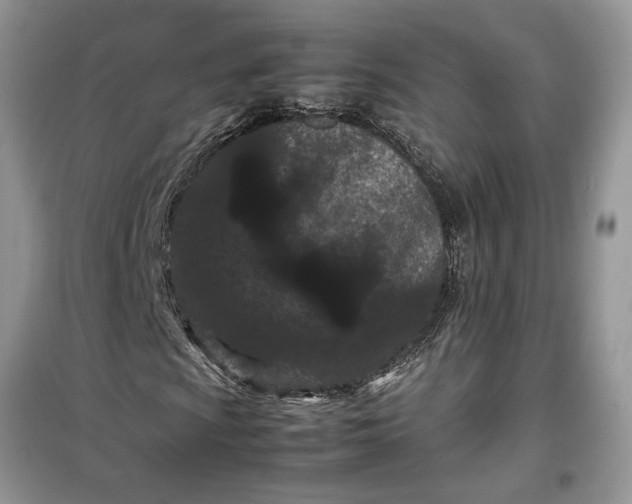 X0000099491009200805291102