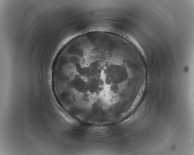 X0000099491035200805291102