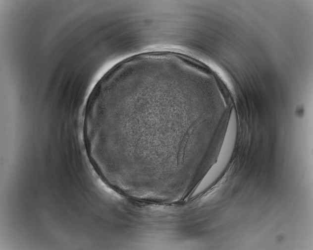 X0000099491102200805291101