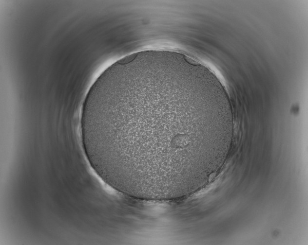 X0000099491103200805291101