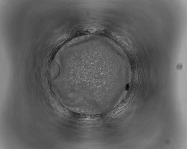 X0000099491105200805291101