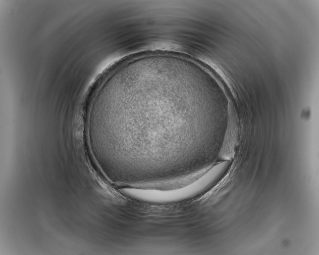 X0000099491115200805291101