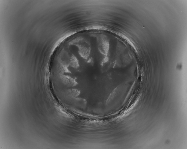 X0000099491117200805291101