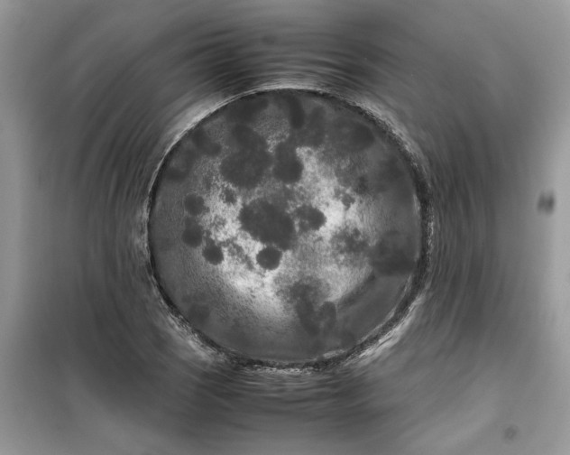 X0000099491121200805291101