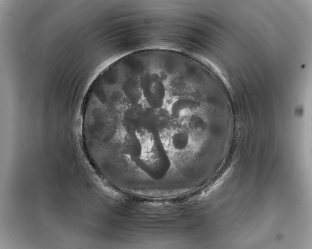 X0000099491125200805291101