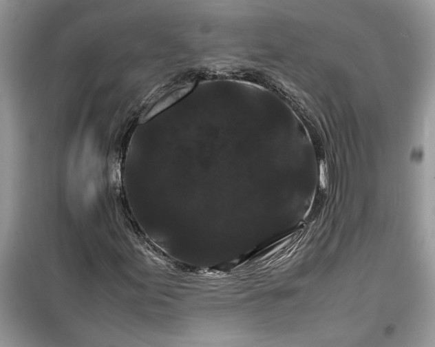 X0000099491155200805291101