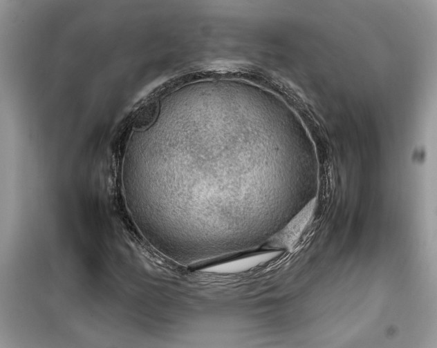 X0000099491158200805291101