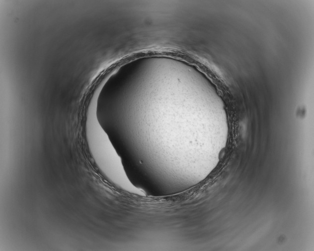 X0000099491160200805291101