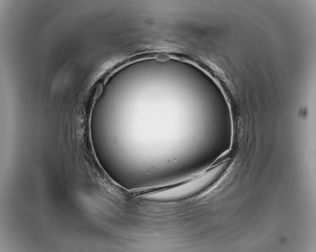 X0000099491163200805291100