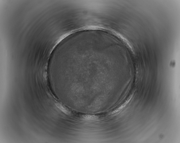 X0000099491170200805291100