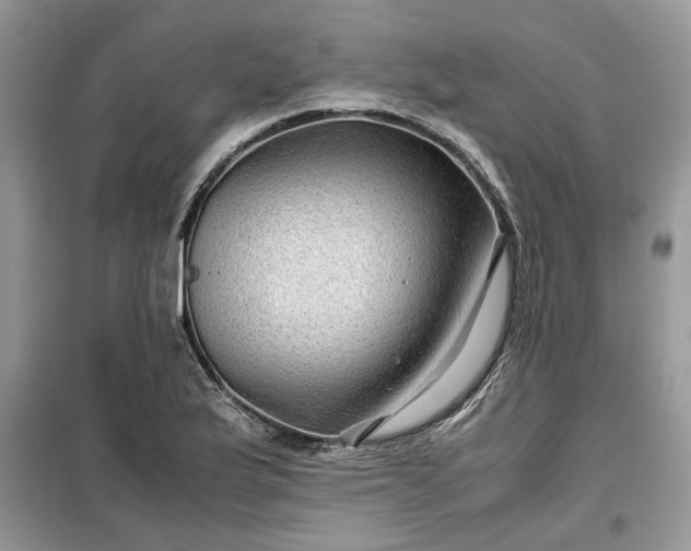 X0000099491175200805291100