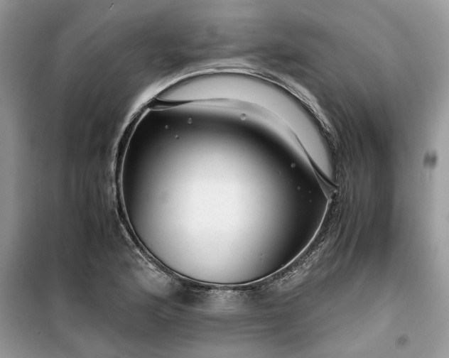 X0000099491176200805291100