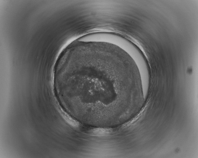 X0000099491179200805291100