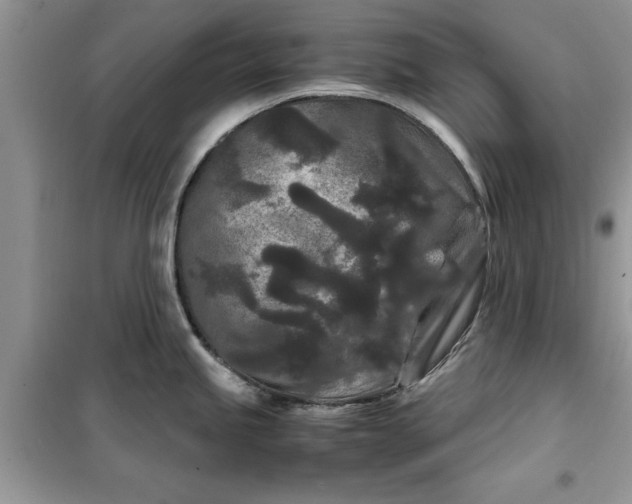 X0000099491245200805291100