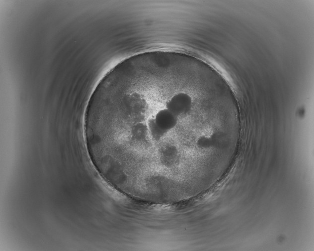 X0000099491283200805291059