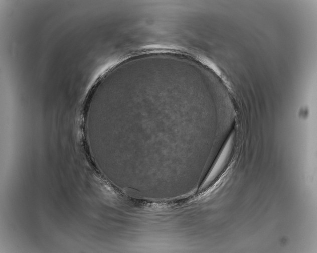 X0000099491357200805291058