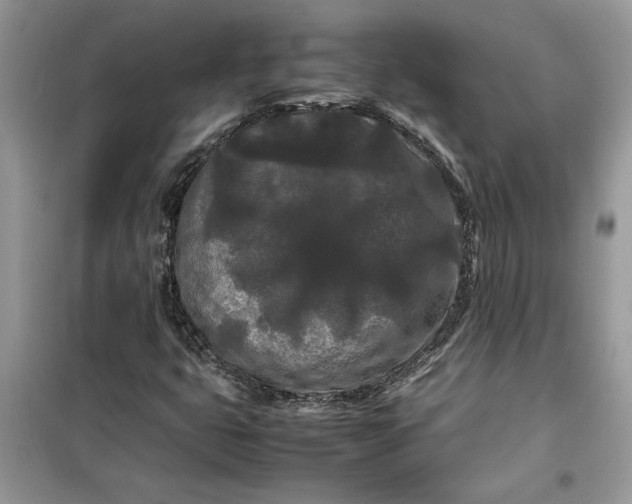 X0000099491399200805291056