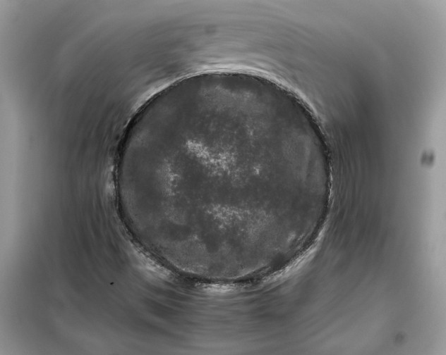X0000099491497200805291055