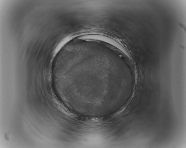 X0000099490056200806051108