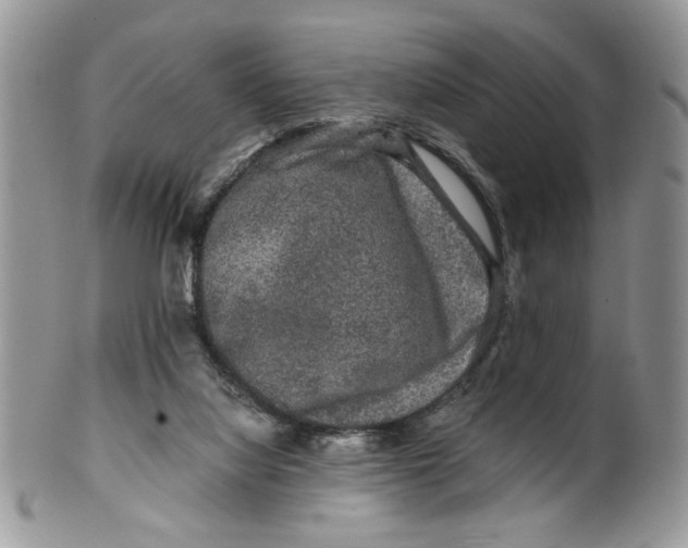 X0000099490068200806051108