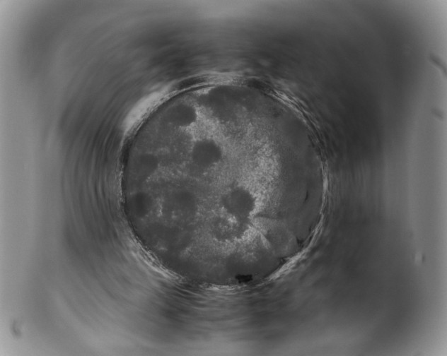 X0000099490149200806051107