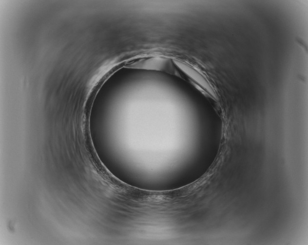 X0000099490152200806051107