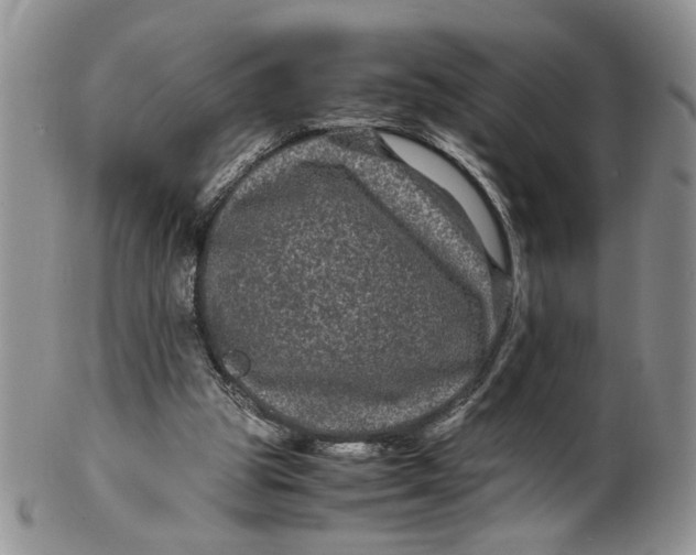 X0000099490153200806051107