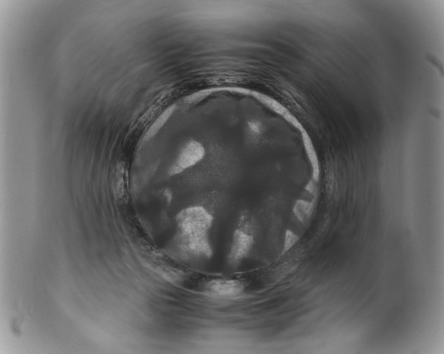 X0000099490169200806051107