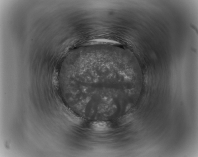 X0000099490181200806051107