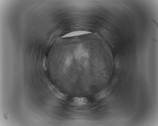 X0000099490185200806051107